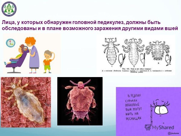 Презентация на тему педикулез