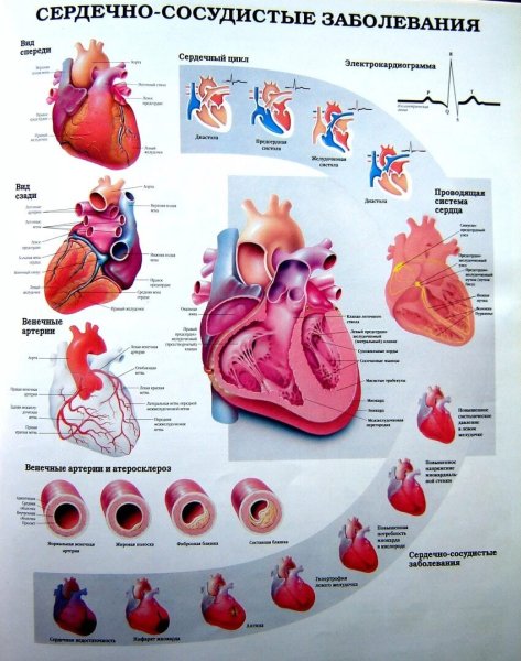 Памятка реабилитация после инфаркта миокарда
