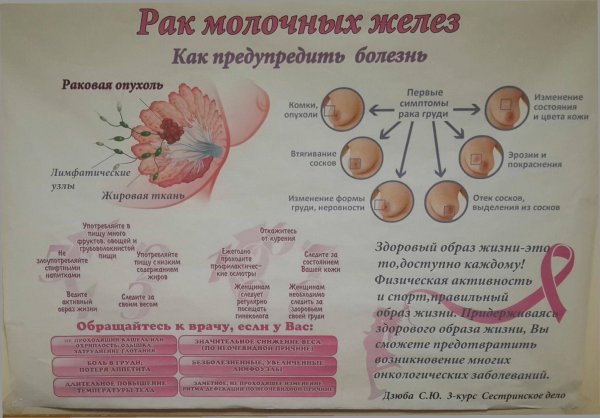 Санбюллетень онкология молочной железы