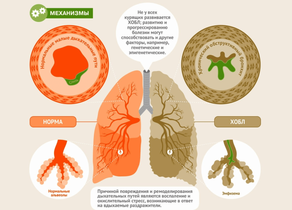 Туберкулез раскраска