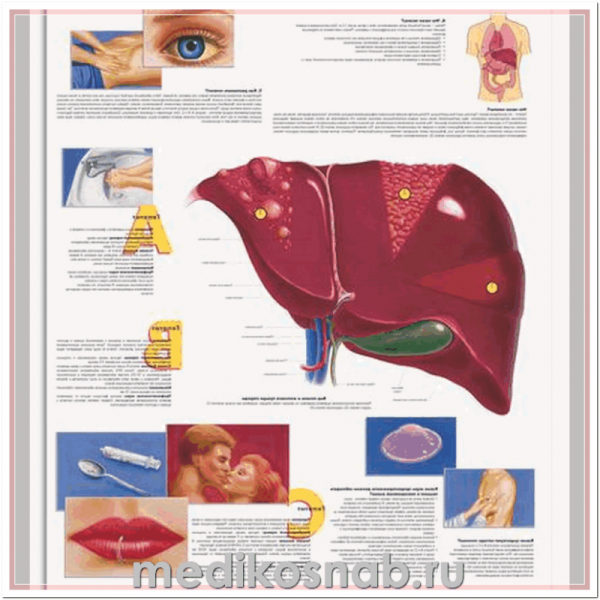 Гепатит плакат