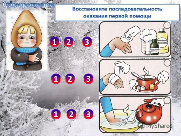 Обморожение оказание первой