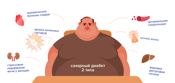 Причины ожирения