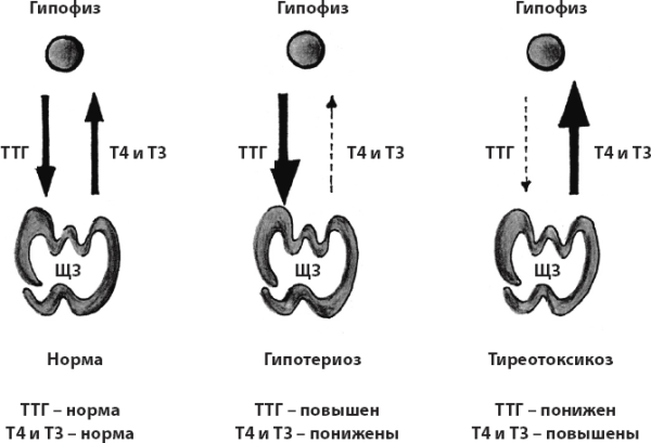 Схема ТТГ т3 т4