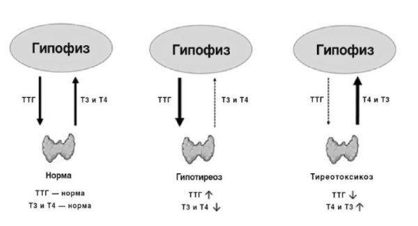 Гипотиреоз показатели ТТГ т3 и т4