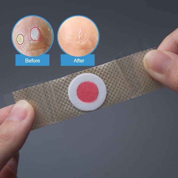Мозольный пластырь для бородавок
