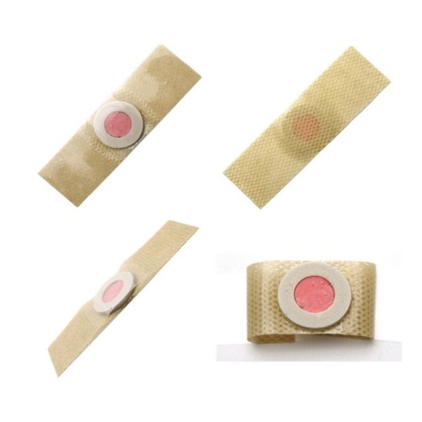 Нейропатическая язва стопы