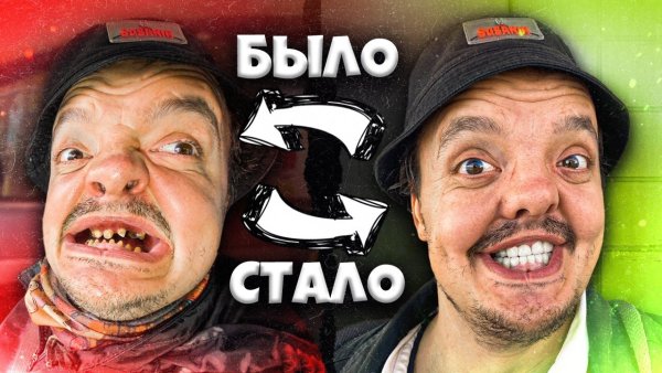 Супер Сус зубы до и после