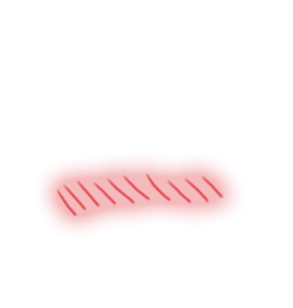 Розовые полоски на щеках