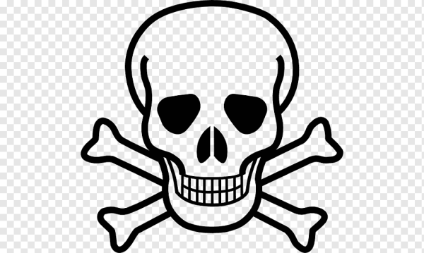 Кости черепа