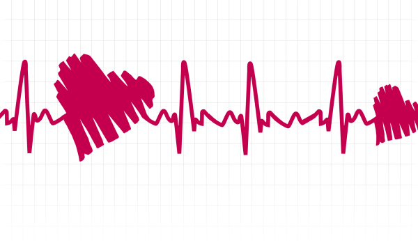 "Ритм" (сердечный)