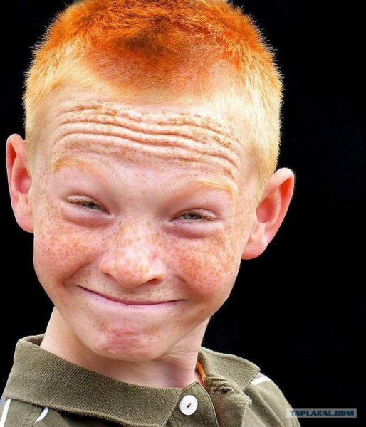 Лысый рыжий