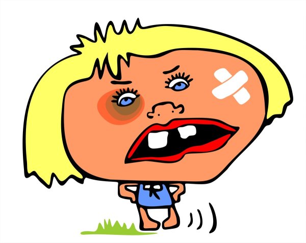 Синяк под глазом рисунок