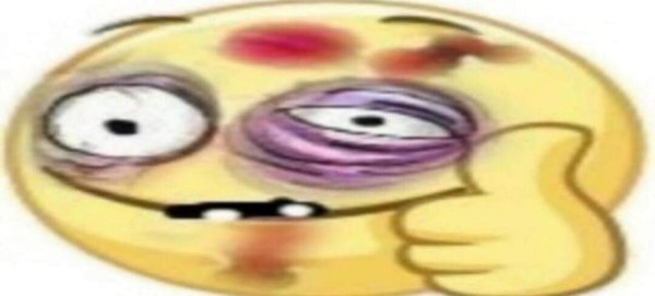 Смайлик с синяком под глазом