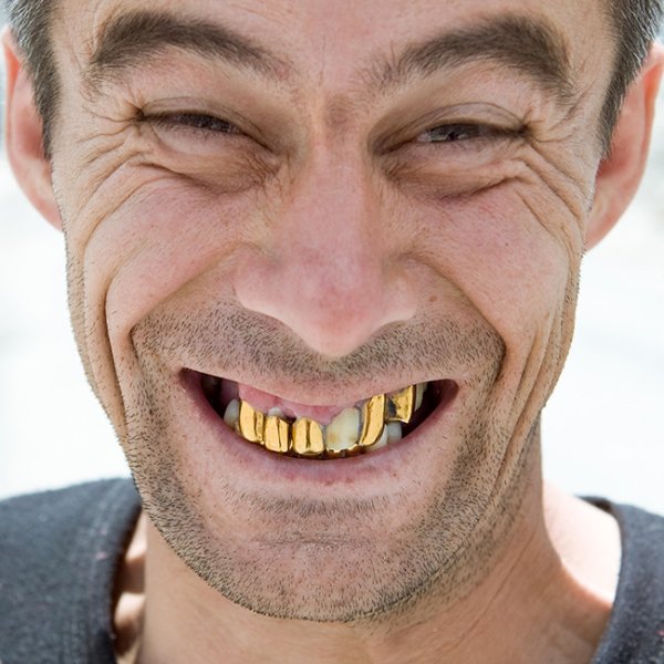 Улыбка зубы мужчина