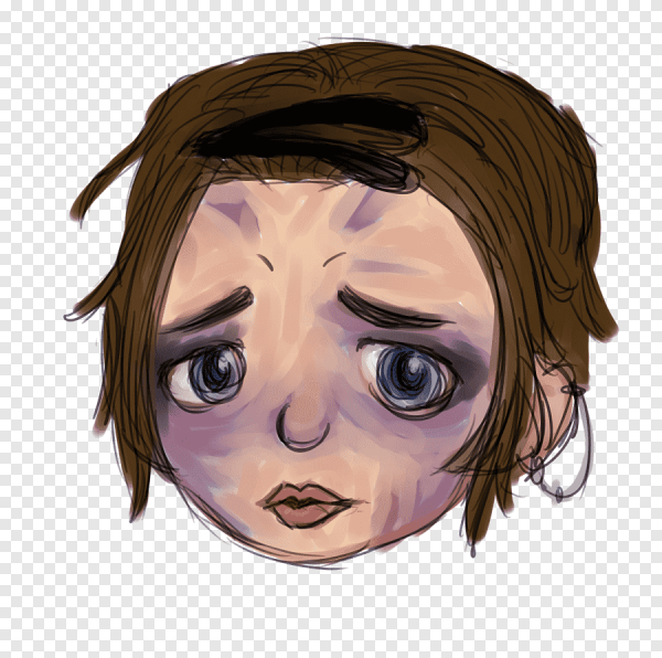 Синяк под глазом рисунок