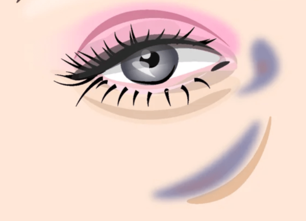 Мешки под глазами арт