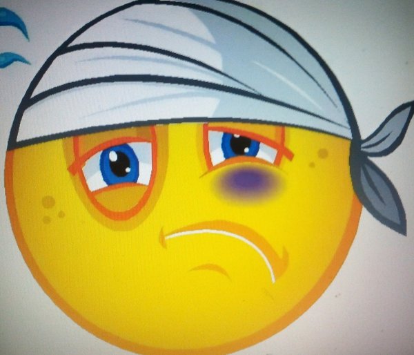 Смайлик с синяком под глазом