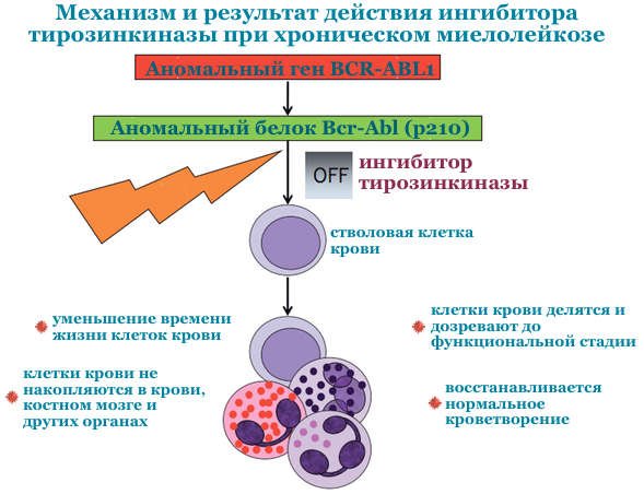Хронический миелолейкоз патогенез