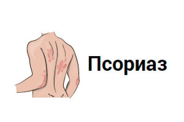 Международный день псориаза