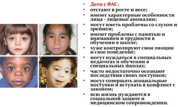 ФАС фетальный алкогольный синдром