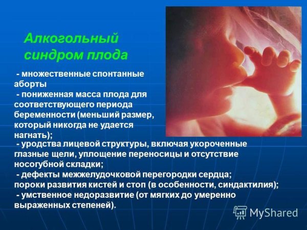 Внутриутробные уродства плода