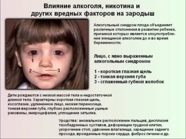 Дети алкоголиков алкогольно-фетальный синдром