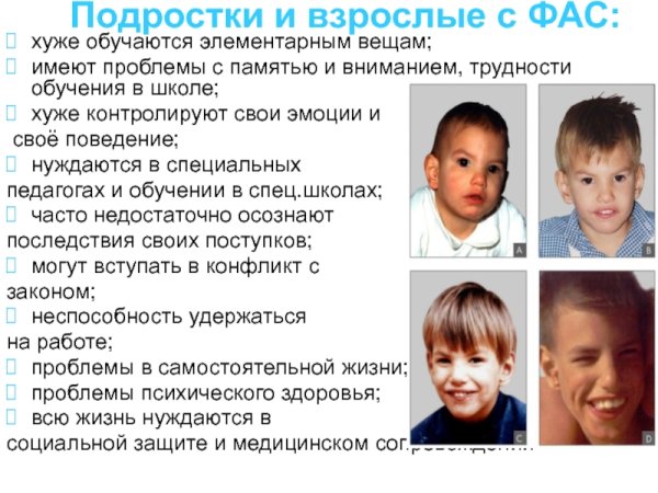 Алкогольный синдром у детей