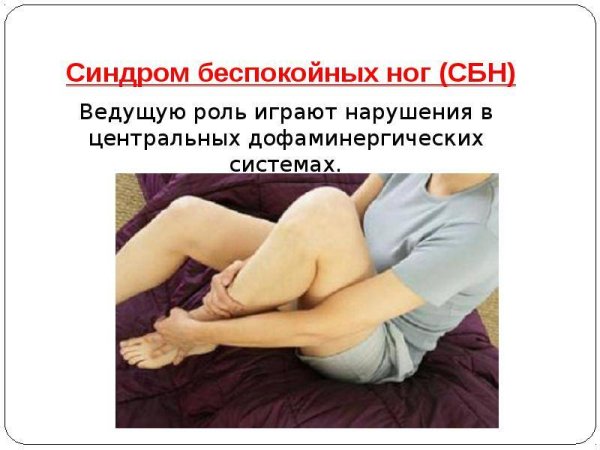 Синдром беспокойных ног
