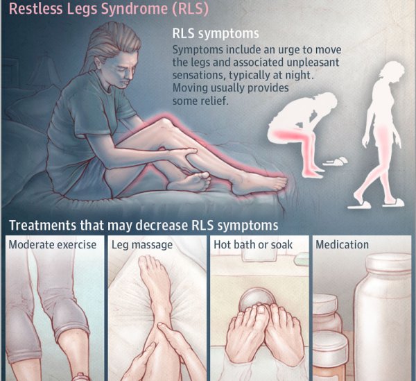 Синдром тяжелых ног картинка