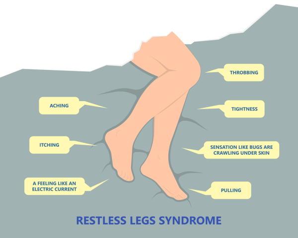 Синдром беспокойных ног картинки