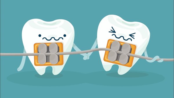 Брекеты мультяшные