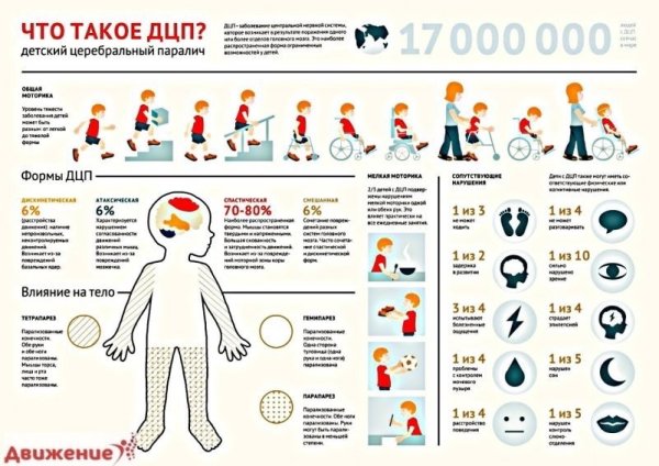 Профилактика ДЦП У детей