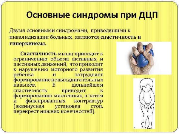 Спастичность мышц при ДЦП