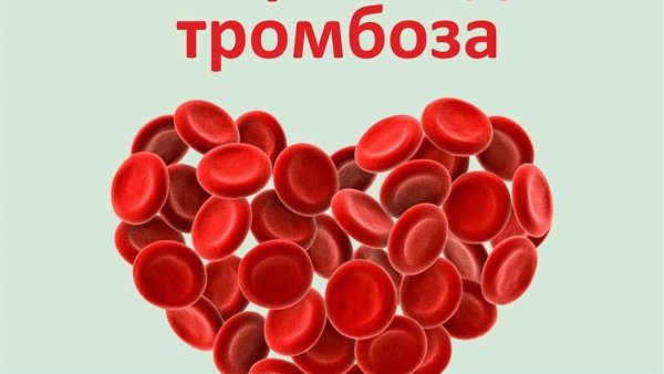 13 Октября Всемирный день тромбоза