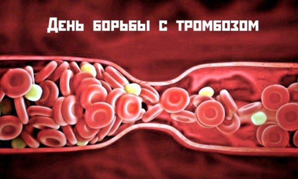 Всемирный день тромбоза