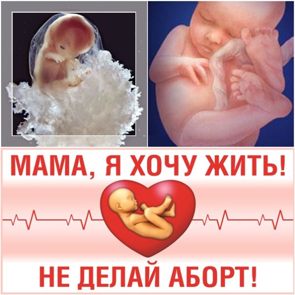 Мама не убивай меня аборт