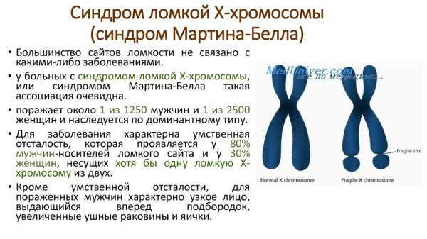 Синдром ломкой х-хромосомы синдром Мартина-Белл