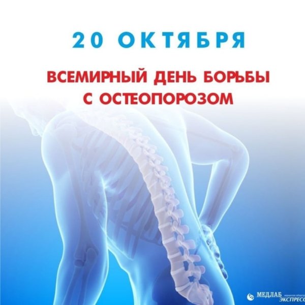Всемирный день борьбы с остеопорозом