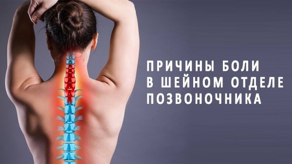 Шейный отдел позвоночника боли