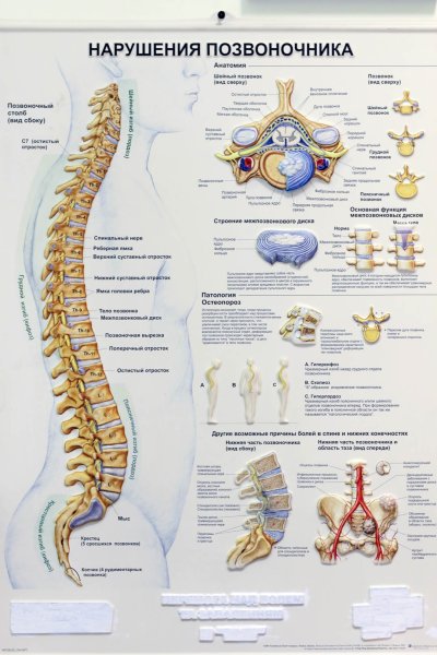 1 Поясничный позвонок схема