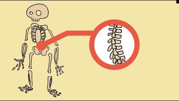 Всемирный день детской кости и суставов