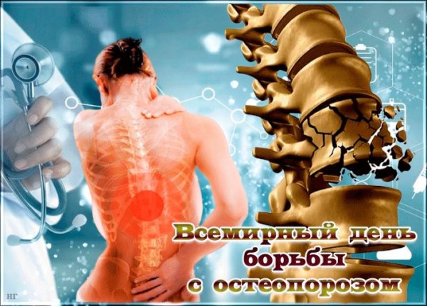 Всемирный день профилактики остеопороза