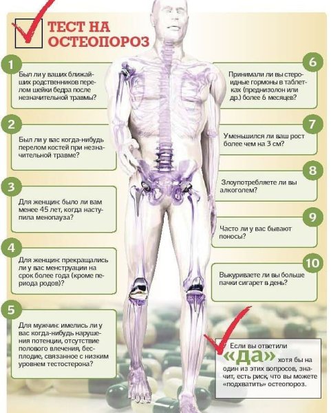 Профилактика остеопороза