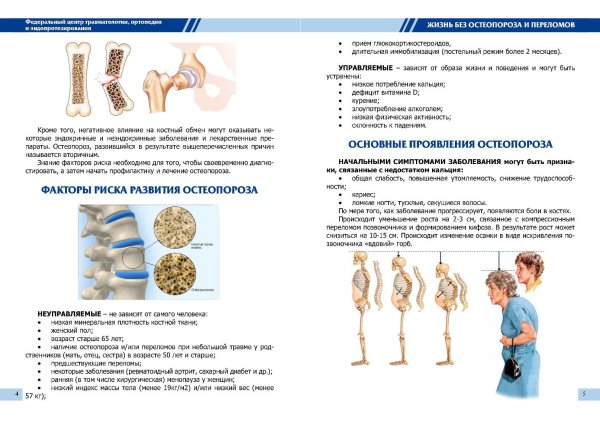 Профилактика остеопороза памятка