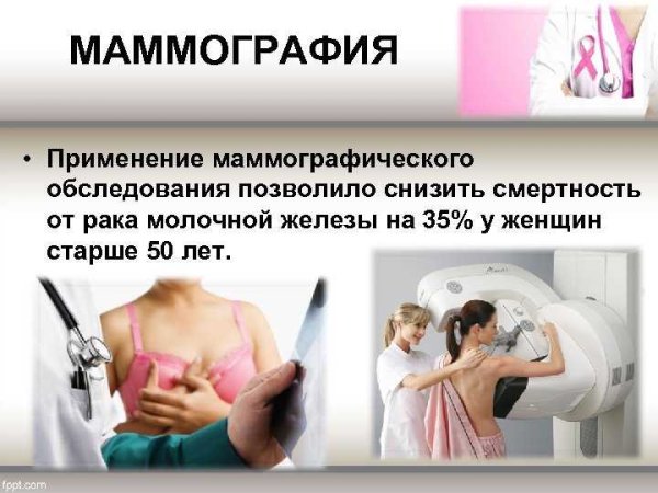 Маммография памятка