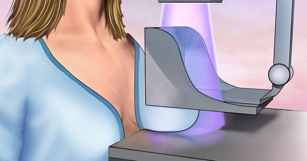 Маммография день цикла