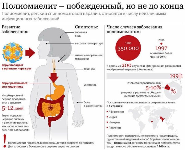 Основные клинические симптомы полиомиелита