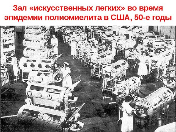 Полиомиелит в Америке эпидемия