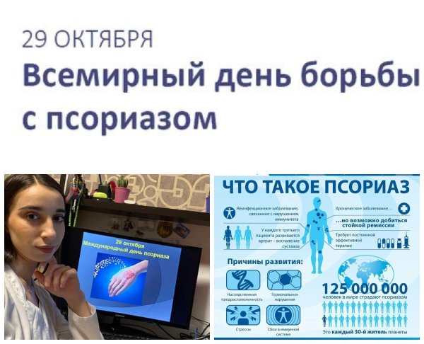 Международный день псориаза 29 октября 2021